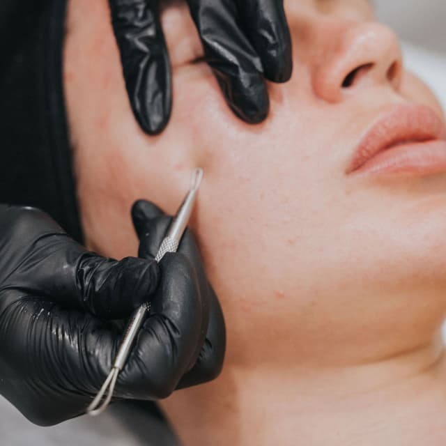 NUA Clear Skin Journey at Nua Skin Atelier in Tampa, FL